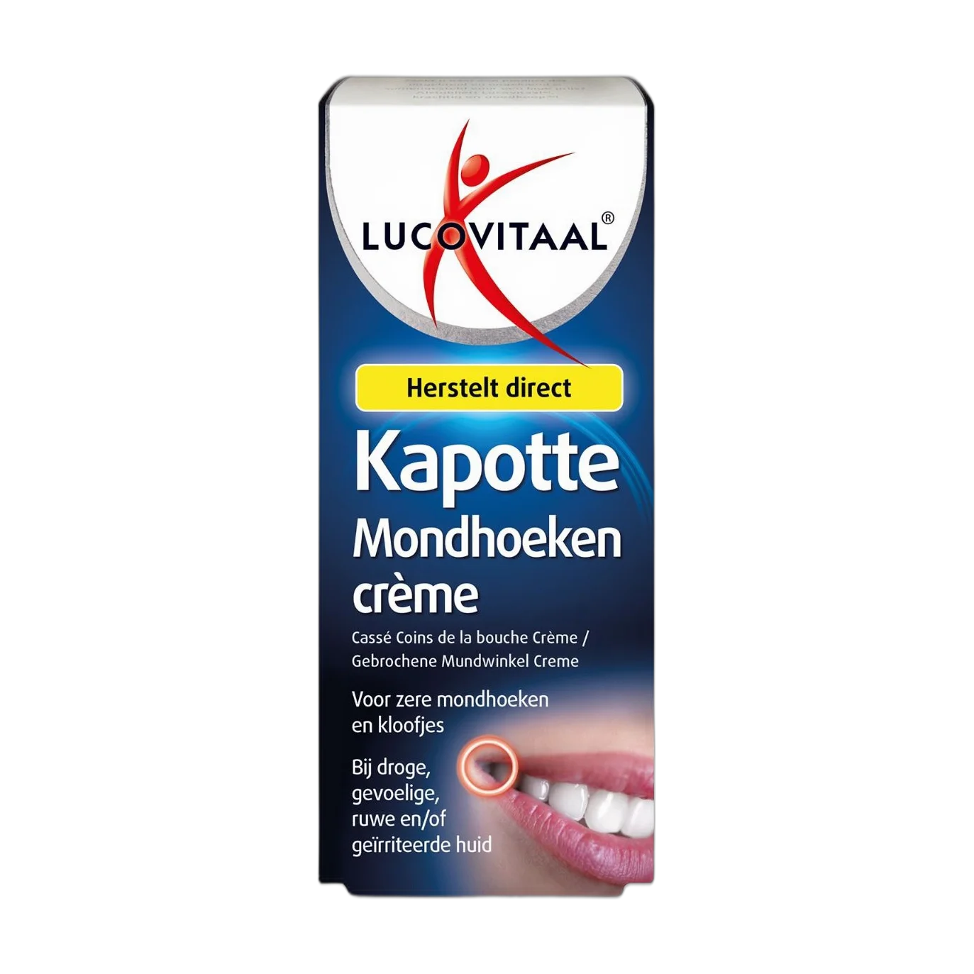 Kapotte Mondhoeken Crème