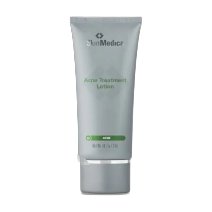Acne Treatment Lotion